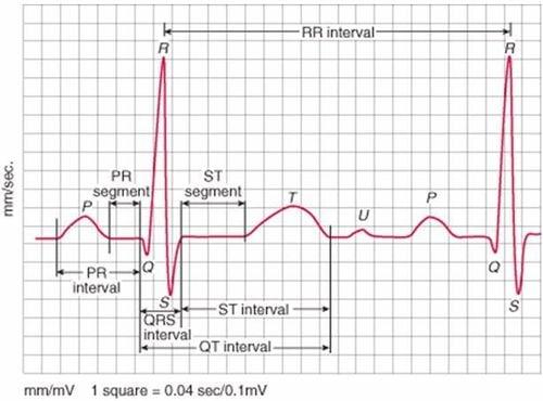 Vị trí và giới hạn bình thường của sóng P trên ECG